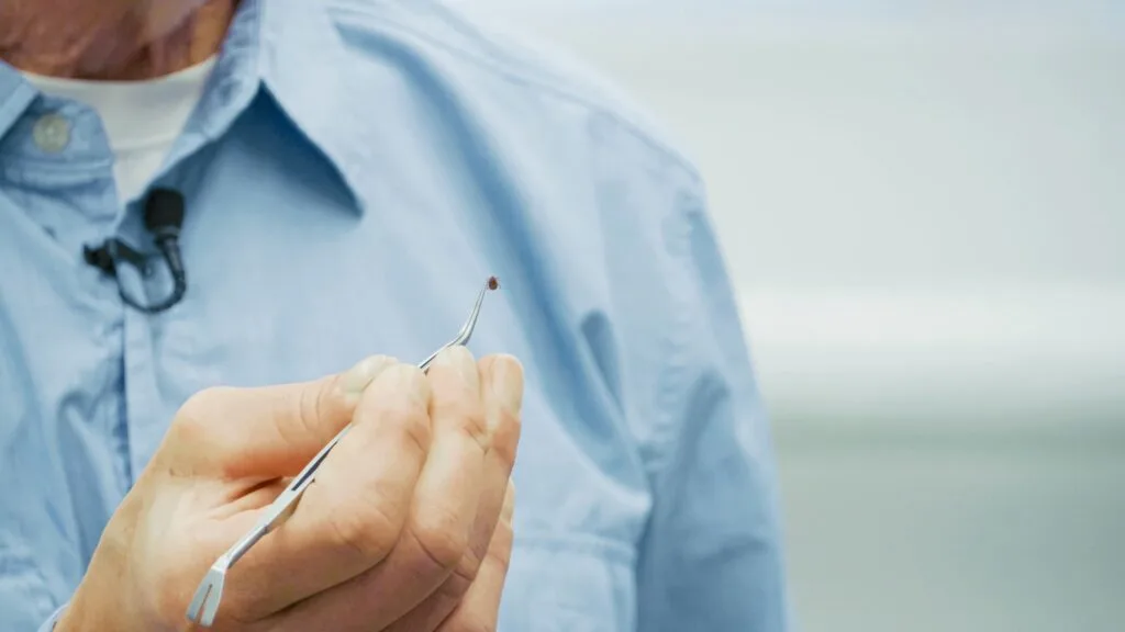 Dr. Thomas Mather holds a tick with tweezers.